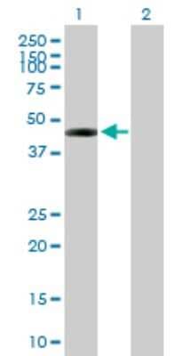 Western Blot: DSCC1 Antibody [H00079075-B01P]