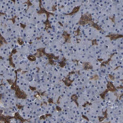 Immunohistochemistry-Paraffin: DSCR4 Antibody [NBP1-84295]