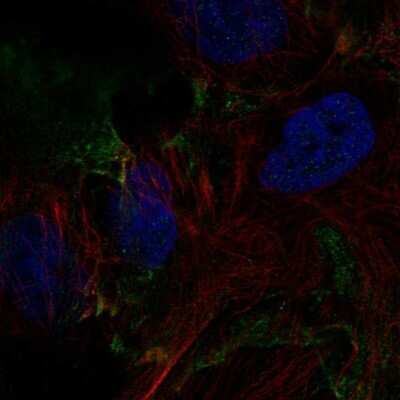 Immunocytochemistry/ Immunofluorescence: DSEL Antibody [NBP2-56370]