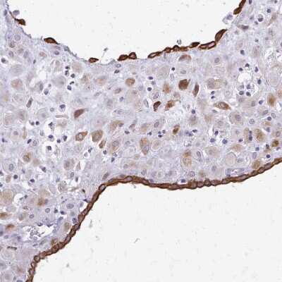 Immunohistochemistry-Paraffin: DSPG3/EPYC Antibody [NBP2-33445]