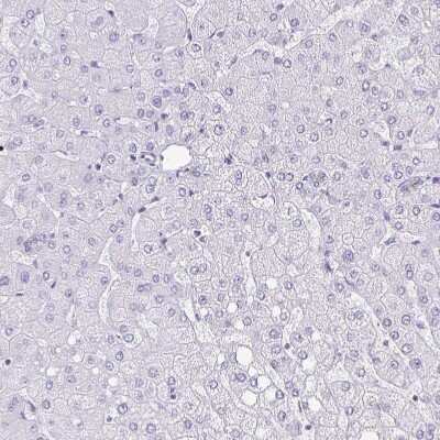 Immunohistochemistry-Paraffin: DSPG3/EPYC Antibody [NBP2-33445]