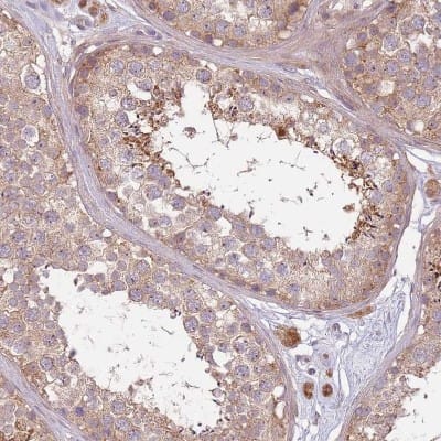 Immunohistochemistry-Paraffin: DTD2 Antibody [NBP2-14375]
