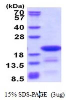 SDS-PAGE: Recombinant Human DTD2 His Protein [NBP2-51523]