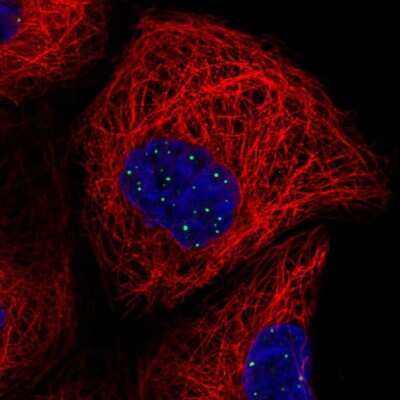 Immunocytochemistry/ Immunofluorescence: DTW Domain Containing 2 Antibody [NBP2-58397]