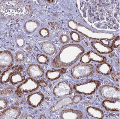 Immunohistochemistry-Paraffin: DTWD1 Antibody [NBP2-30570]