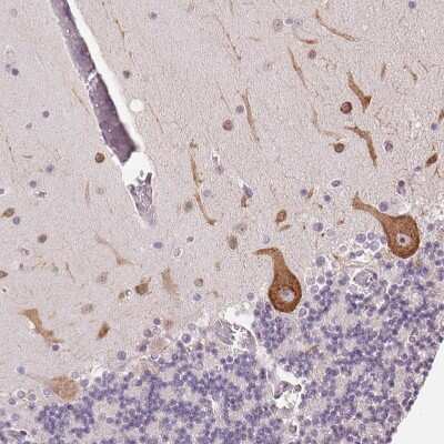 Immunohistochemistry-Paraffin: DTX1 Antibody [NBP2-58472]