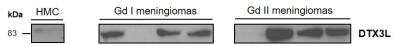 Western Blot: DTX3L Antibody (1D10) [H00151636-M01]