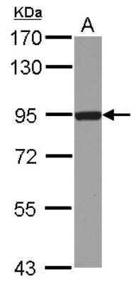 Western Blot: DTX3L Antibody [NBP2-16230]