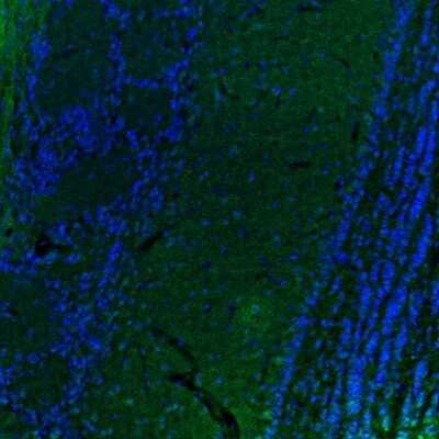 Immunocytochemistry/ Immunofluorescence: DTX4 Antibody [NBP2-32448]