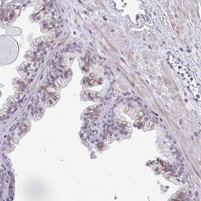 Immunohistochemistry: DTX4 Antibody [NBP2-32448]