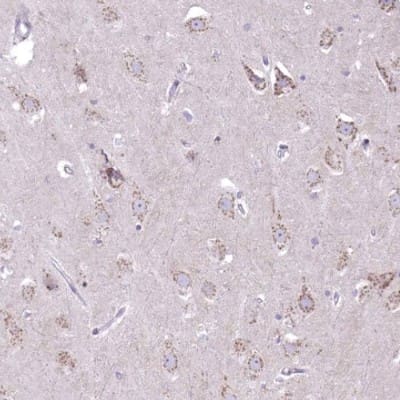 Immunohistochemistry-Paraffin: DTX4 Antibody [NBP2-32448]