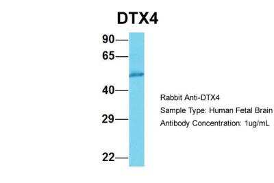 Western Blot: DTX4 Antibody [NBP2-84824]