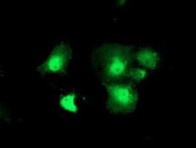 Immunocytochemistry/ Immunofluorescence: DTYMK Antibody (OTI1G8) - Azide and BSA Free [NBP2-70604]