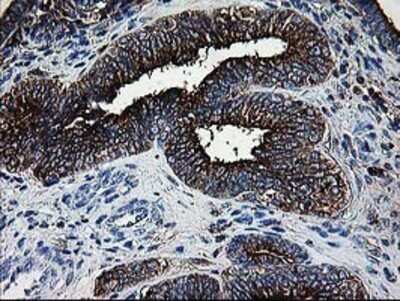 Immunohistochemistry: DTYMK Antibody (OTI1G8) - Azide and BSA Free [NBP2-70604]