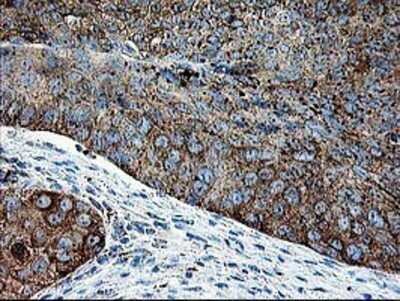 Immunohistochemistry: DTYMK Antibody (OTI1G8) - Azide and BSA Free [NBP2-70604]