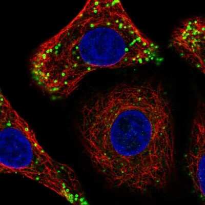 Immunocytochemistry/ Immunofluorescence: DULLARD Antibody [NBP2-68840]