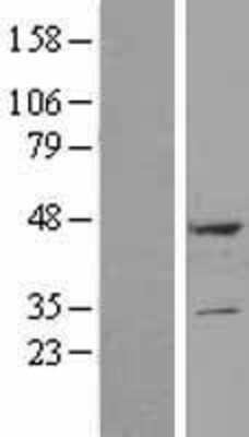Western Blot: DULLARD Overexpression Lysate [NBL1-10040]