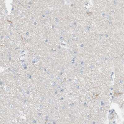 Immunohistochemistry-Paraffin: DUOX1 Antibody [NBP1-81301]