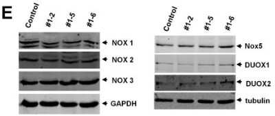 Western Blot: DUOX2 AntibodyBSA Free [NB110-61576]