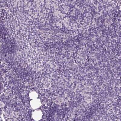Immunohistochemistry-Paraffin: DUOXA2 Antibody [NBP2-57547]