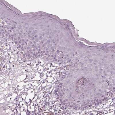 Immunohistochemistry-Paraffin: DUOXA2 Antibody [NBP2-57547]