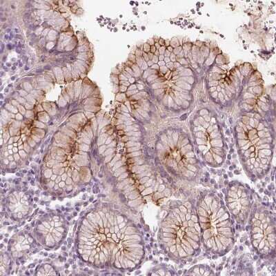 Immunohistochemistry-Paraffin: DUOXA2 Antibody [NBP2-57547]