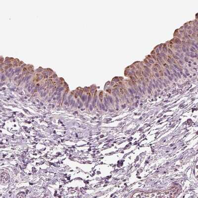 Immunohistochemistry-Paraffin: DUOXA2 Antibody [NBP2-57547]