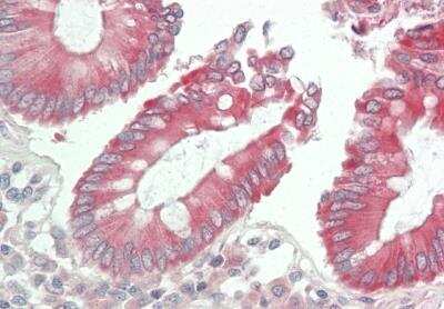Immunohistochemistry-Paraffin: DUOXA2 Antibody [NBP2-82936]