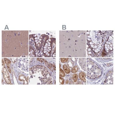 Immunohistochemistry-Paraffin: DUS2L Antibody [NBP1-91852]