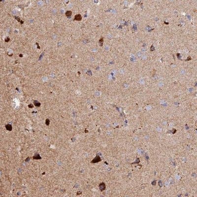 Immunohistochemistry-Paraffin: DUS3L Antibody [NBP1-84042]