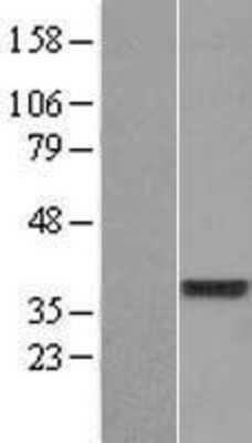 Western Blot: DUS4L Overexpression Lysate [NBP2-04914]