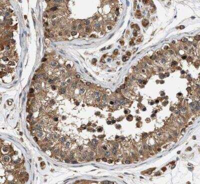 Immunohistochemistry-Paraffin: DUSP14 Antibody [NBP1-81046]