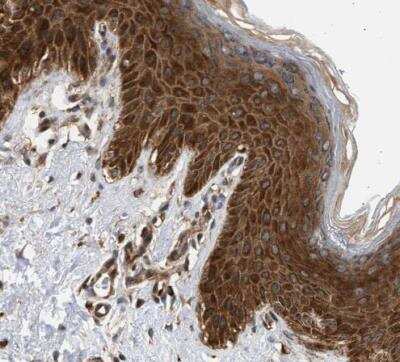 Immunohistochemistry-Paraffin: DUSP14 Antibody [NBP1-81046]