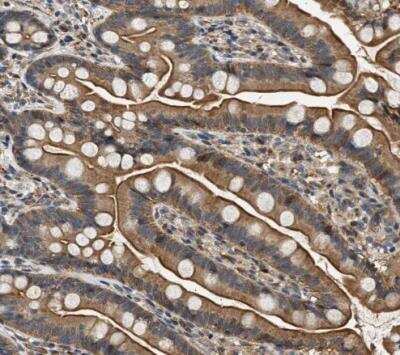 Immunohistochemistry-Paraffin: DUSP14 Antibody [NBP1-81046]