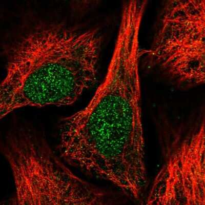 Immunocytochemistry/ Immunofluorescence: DUSP16 Antibody [NBP1-82898]