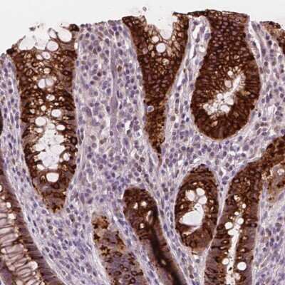 Immunohistochemistry-Paraffin: DUSP16 Antibody [NBP1-82898]
