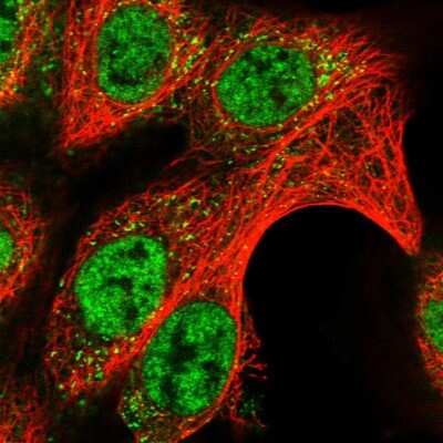 Immunocytochemistry/ Immunofluorescence: DUSP22 Antibody [NBP1-83078]