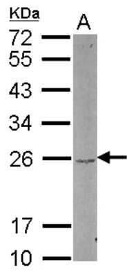 Western Blot: DUSP22 Antibody [NBP2-16239]