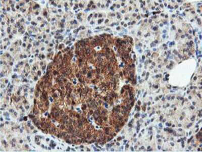 Immunohistochemistry-Paraffin: DUSP23 Antibody (OTI3C10) [NBP2-01507]