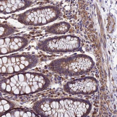Immunohistochemistry-Paraffin: DUSP23 Antibody [NBP1-91855]