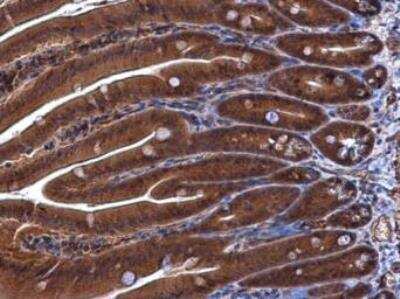 Immunohistochemistry-Paraffin: DUSP23 Antibody [NBP2-16240]