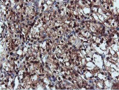 Immunohistochemistry: DUSP23 Antibody (OTI3C10) - Azide and BSA Free [NBP2-71976]