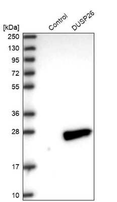 Western Blot: DUSP26 Antibody [NBP2-33880]