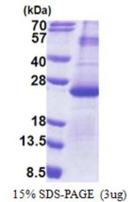 SDS-PAGE: Recombinant Human DUSP26 His Protein [NBP2-23009]