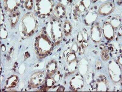Immunohistochemistry-Paraffin: DUSP27/DUPD1 Antibody (OTI7E4) [NBP2-03339]