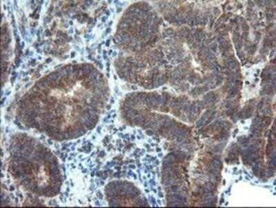 Immunohistochemistry: DUSP27/DUPD1 Antibody (OTI7E4) - Azide and BSA Free [NBP2-72503]