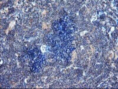 Immunohistochemistry: DUSP27/DUPD1 Antibody (OTI7E4) - Azide and BSA Free [NBP2-72503]