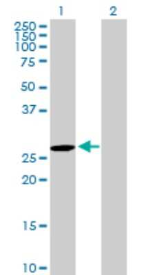 Western Blot: DUSP27/DUPD1 Antibody [H00338599-B01P]