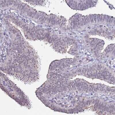 Immunohistochemistry: DUSP28 Antibody [NBP1-94058]