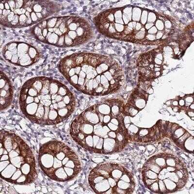 Immunohistochemistry-Paraffin: DUSP28 Antibody [NBP1-94058]